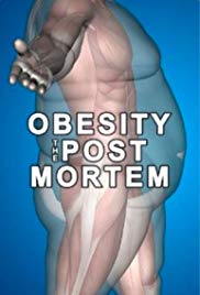 Obesity: The Post 